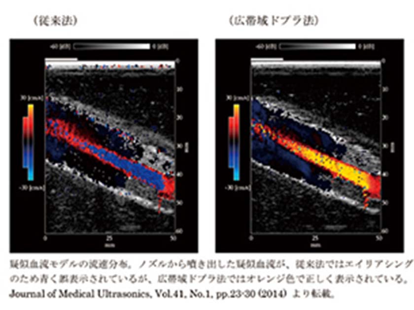 高速血流観測のための広帯域ドプラ法