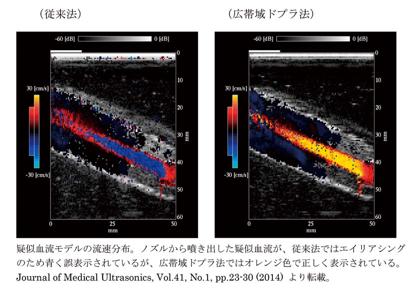 超音波の情報的応用で医療に貢献1